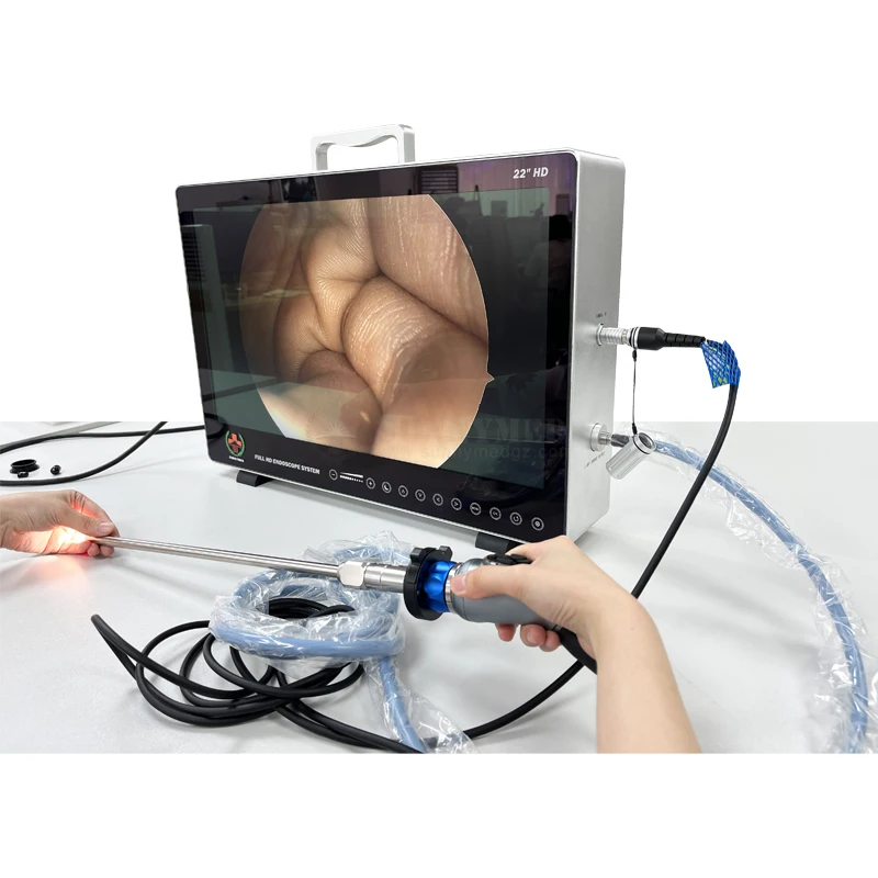 

SY-PS050 In Stock! HD Camera Endoscope for Diagnosis of ENT/ Urology Medical 1080 HD Endoscopy System Price