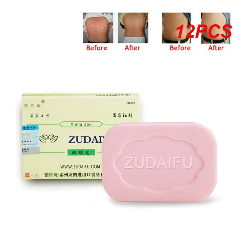 

12 шт. Zudaifu серное мыло очищающее средство с контролем жирности Отбеливающее серное мыло для лица очищающее средство для кожи мыло ручной работы