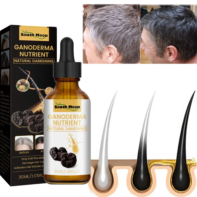 

Hair Removal Serum Treatment Moisturizes Naturally Produces Melanin Color Repair Anti-Hair Loss Product for Men Women Hair Oil