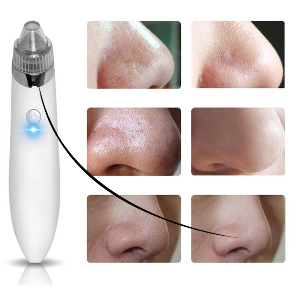 

Remover Acne Point Noir Blackhead Vacuum Extractor Tool Black Spots Pore Cleaner Skin Care Facial Pore Cleaner Machine 2 Color