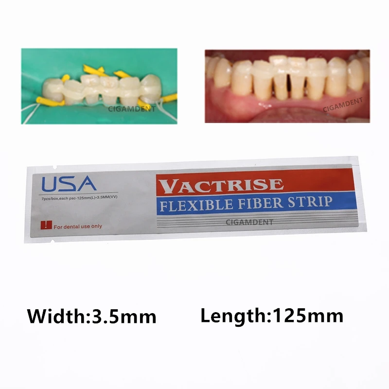 

1Pc Dental Fiber Splint Glass Flexible Fiber Strip Composite Resin Light-Cure Bonding Strips Dentistry Material