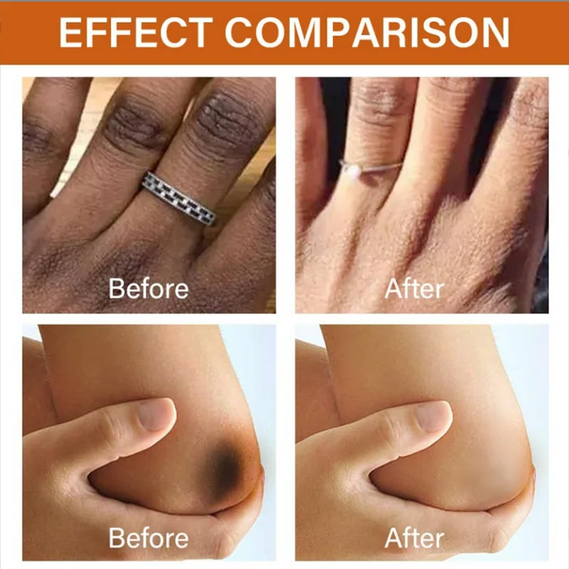 Отбеливающий крем для кожи от Тёмных точек на коже и ногах