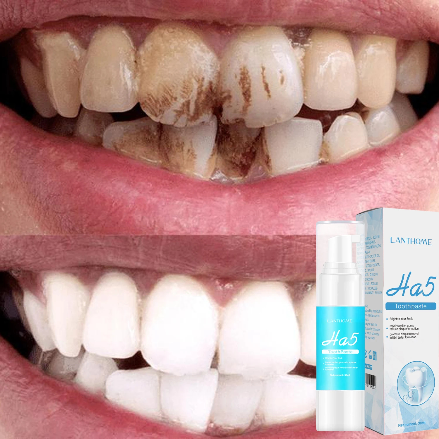 

HA5 Teeth Whitening Tooth Paste Intensive Stain Removal ToothPaste Sensitive Corrector Repair Gums Fresh Breath and Brighten