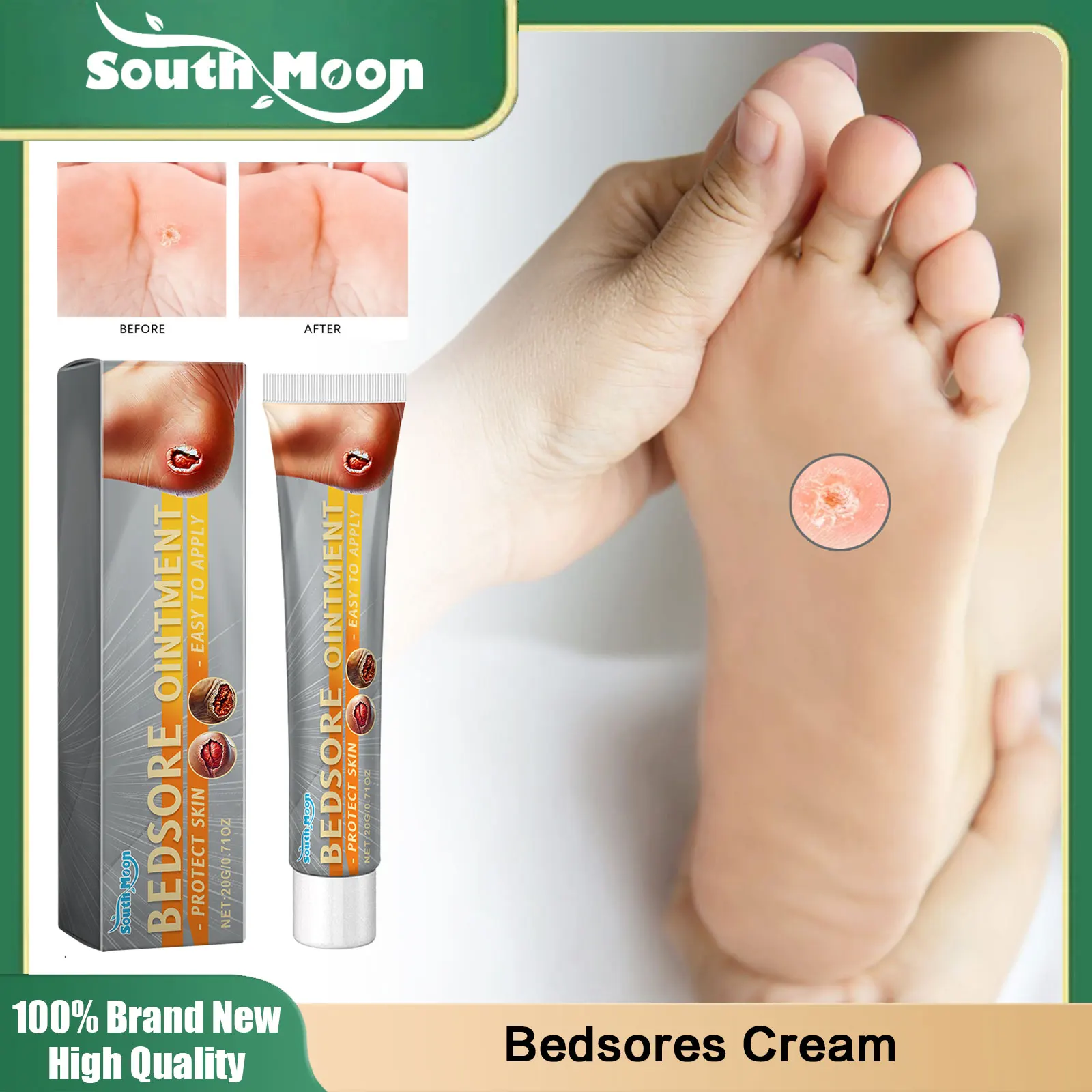 Лечебная мазь South Moon для обезжиренных РАН удаление гнили миогенные обезжиренные