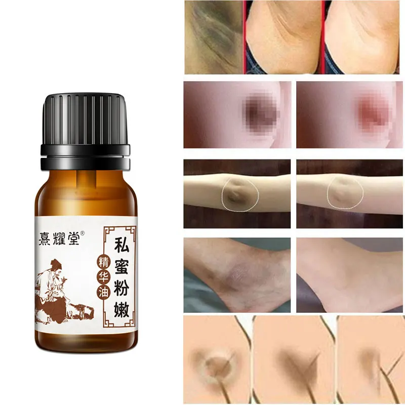 

Women's Private Parts Pink Tender Essence Oil Genitals Underarm Knees Whiten Neck Buttocks Chest Desalination Remove Melanin