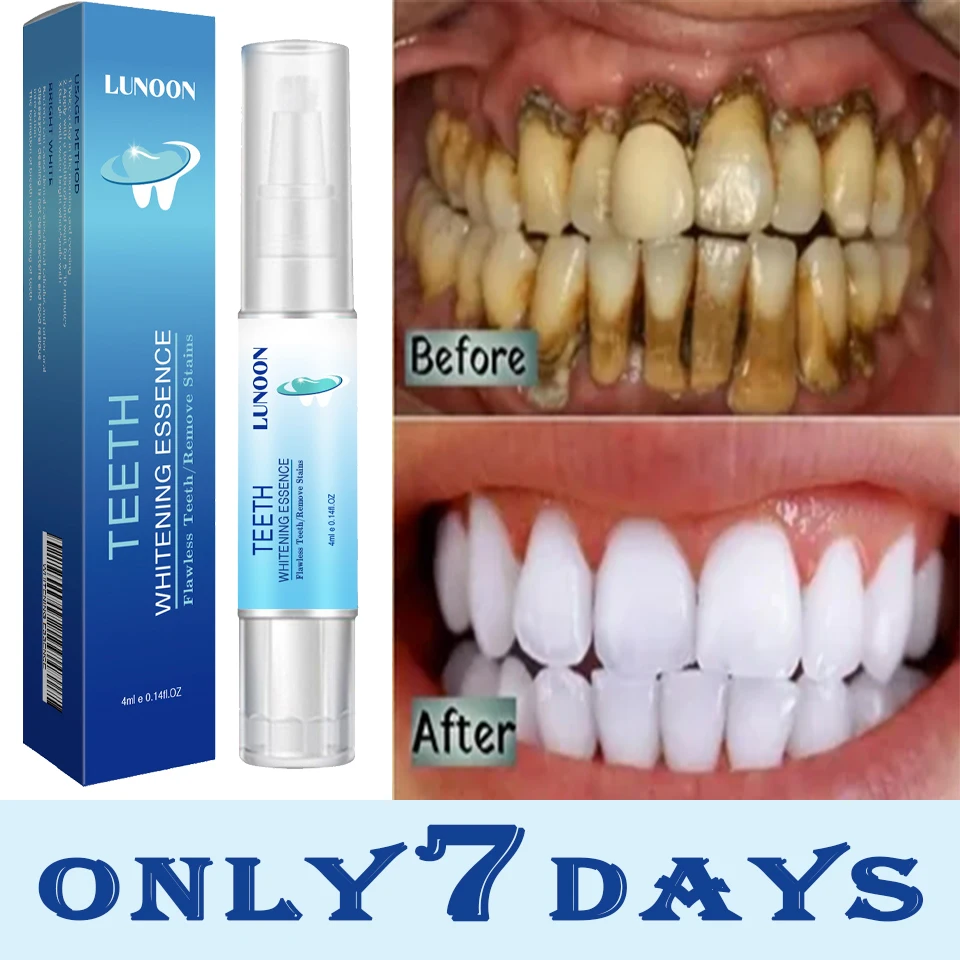 

New Teeth Whitening Pen Tooth Gel Whitener Bleach Remove Stains Instant Smile Teeth Whitening Kit Cleaning Serum Beauty Health