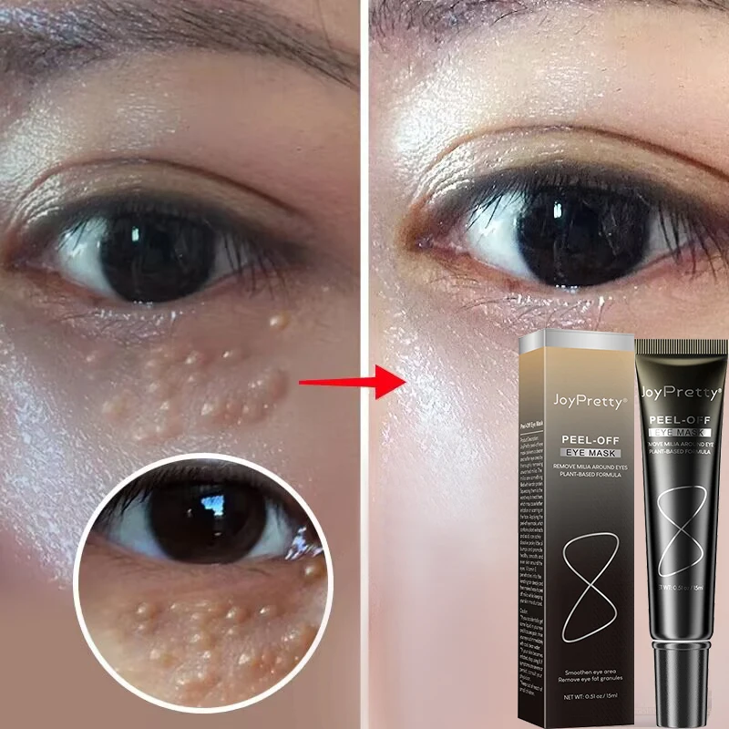 

Remove Fat Granules Eyes Cream Anti Dark Circle Improve Eye Bag Fine Lines Moisturizing Anti-Puffiness Lifting Firming Eye Care