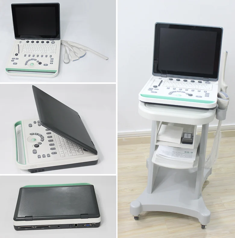 

15 Inch Lcd Notebook Ultrasound Scanner Arm Based System USG