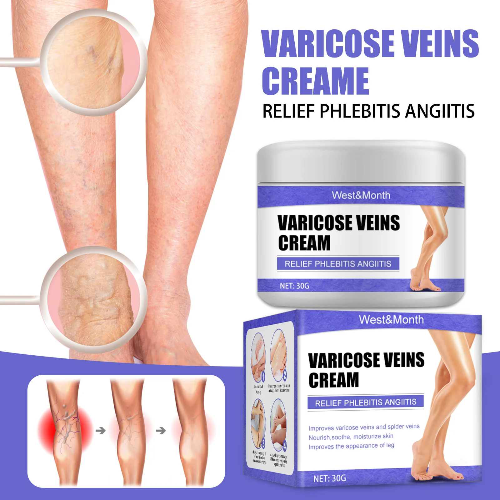 

Herbal Varicose Veins Treatment Cream Relieve Vasculitis Phlebitis Spider Pain Relief Swollen Blood Vessels Leg Body Health Care