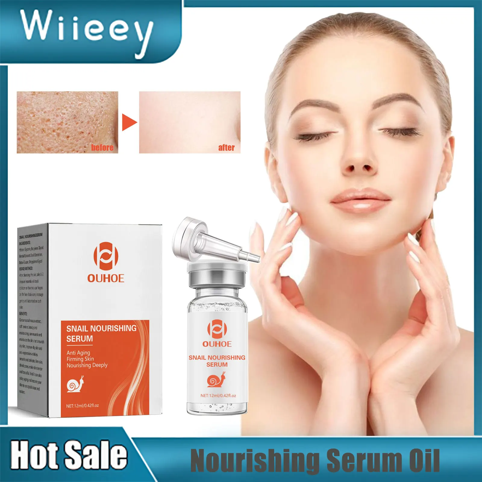 

Pores Shrinking Serum Removal Pimples Repairing Damaged Oil Control Moisturizing Reduce Acne Marks Whitening Remove Acne Essence