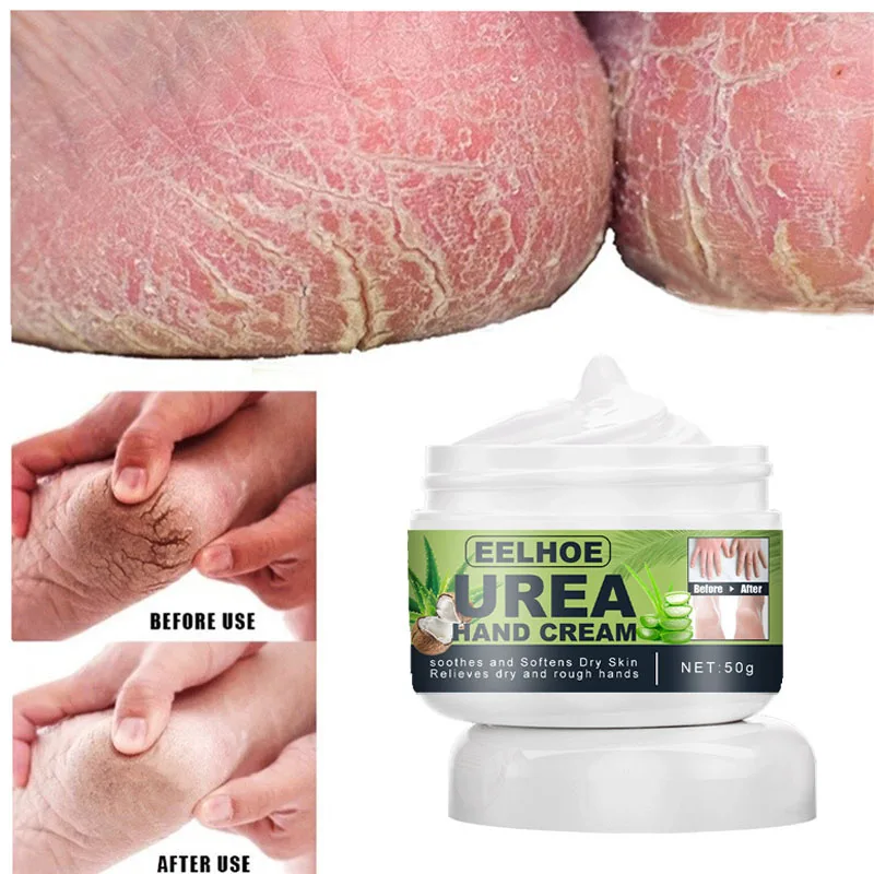 

Anti-Drying Heel Cracked Herbal Anti-Crack Foot Cream Repair Calluse Dead Skin Removal Mask Moisturizing Hand Feet Care