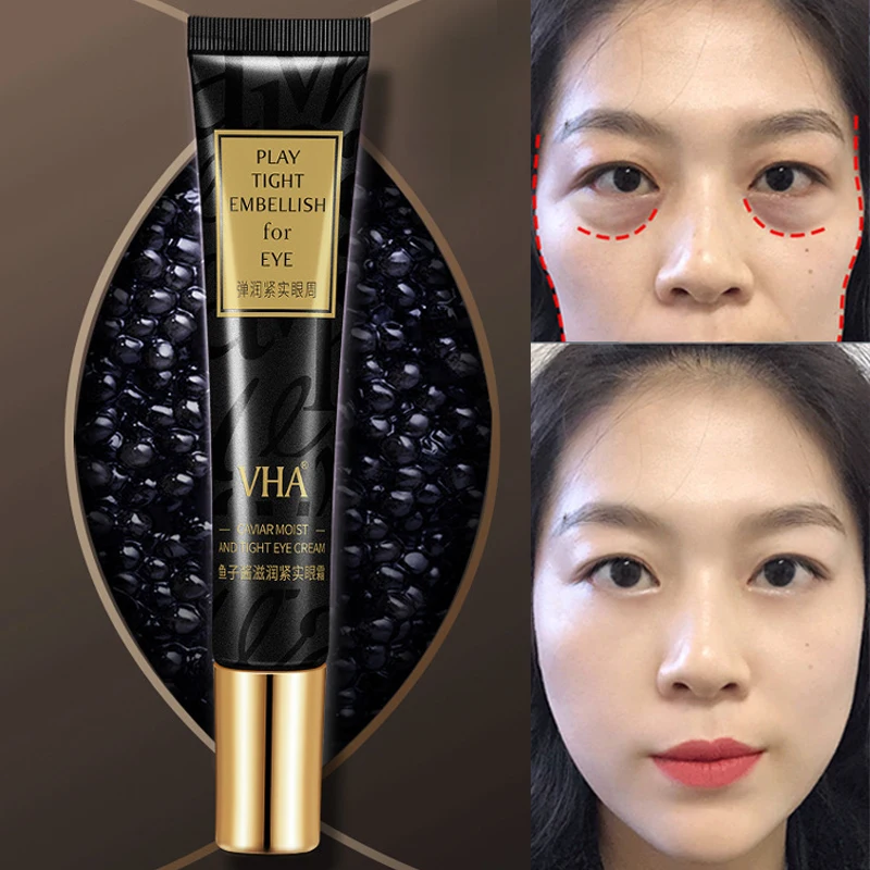 

20g Hydrating Eye Cream with Caviar Extract for Dark Circles and Fine Lines Anti-Aging Eye Serum with Caviar and Hyaluronic Acid