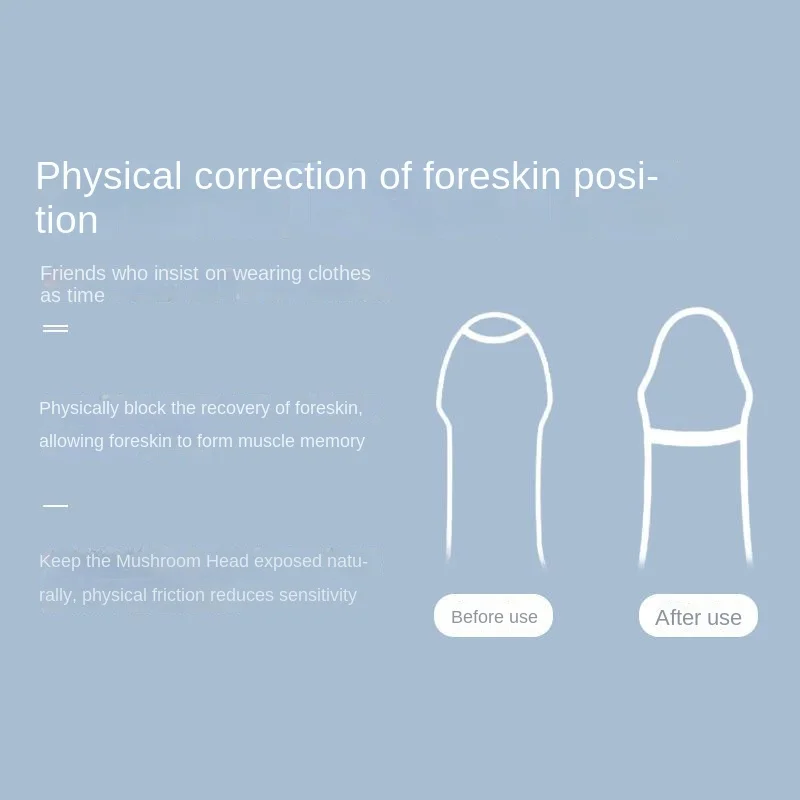 Prepuce Correction Boxers Men's Sex Masturbation Underwear Elastic Sexy Lingerie for Long Cock Gay Special Plus U-convex Panties