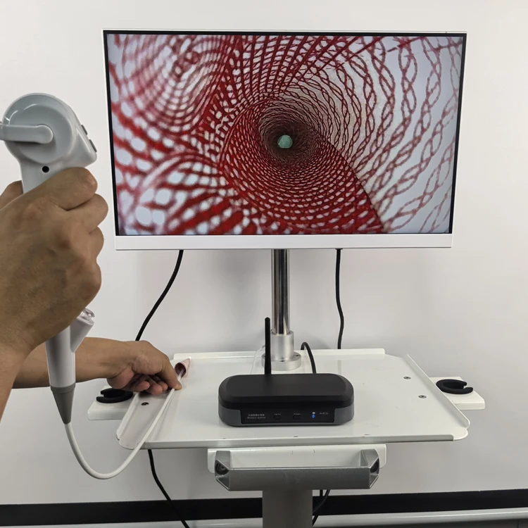 Высокое качество дешевая цена медицинская система визуализации для домашних