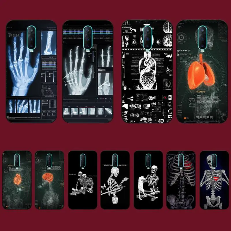 

Radiological human organs Skeleton skull Phone Case for Vivo Y91C Y11 17 19 17 67 81 Oppo A9 2020 Realme c3