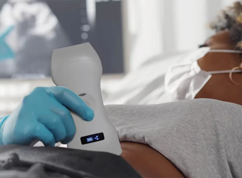Sonostar портативный беспроводной ультразвуковой зонд цветной допплер 192E 3в1