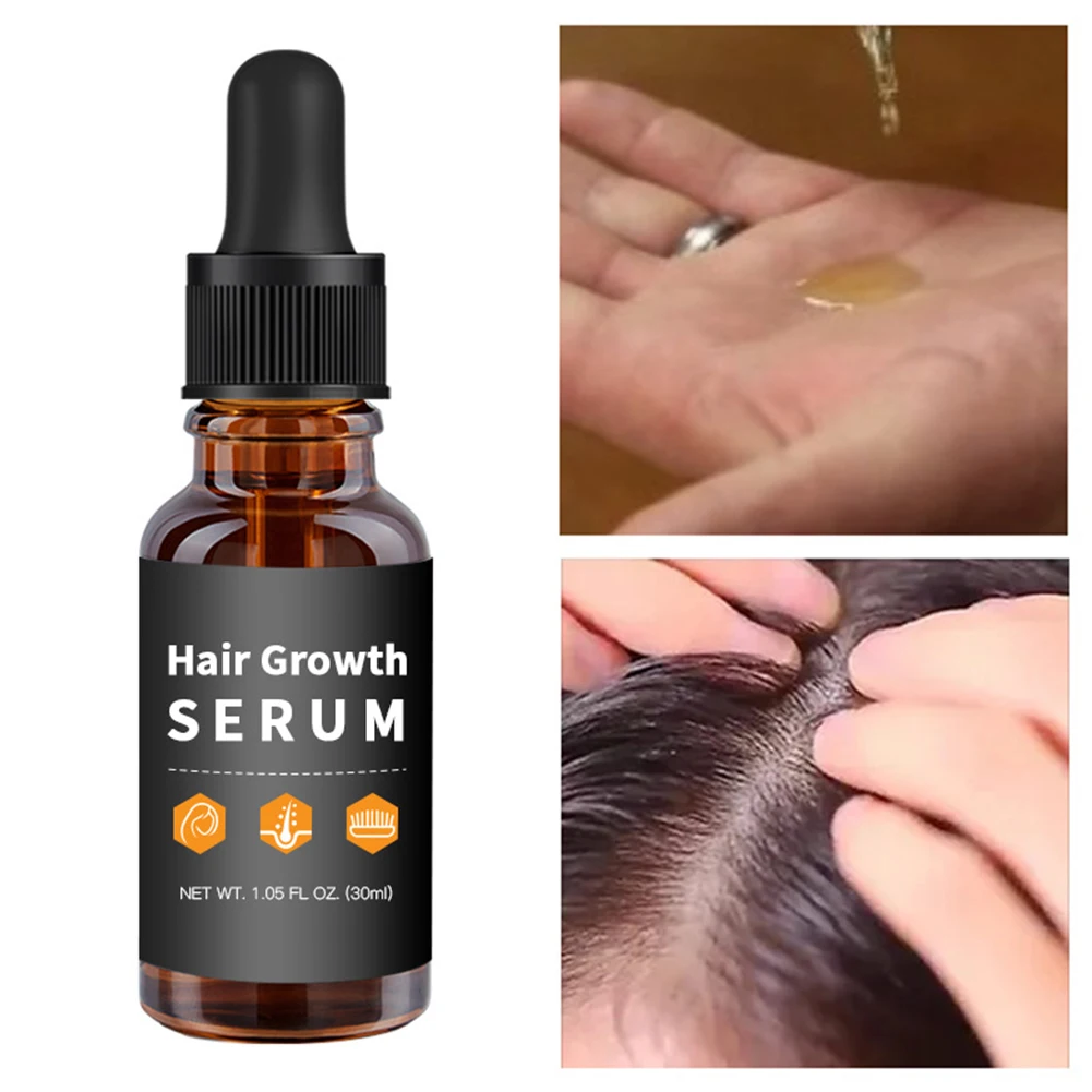 

30ml/1.05fl Oz Shiny Dense Salon Nourish Scalp Men Women Essential Oil Stronger Hair Growth Serum Activate Follicle Thickening