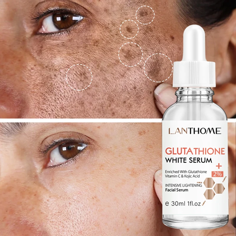 

Vitamin C Essence SkinCare Glutathione Whitening Freckle Serum Remove Melasma Dark Spots Anti-acne Brightening Moisturizing Face