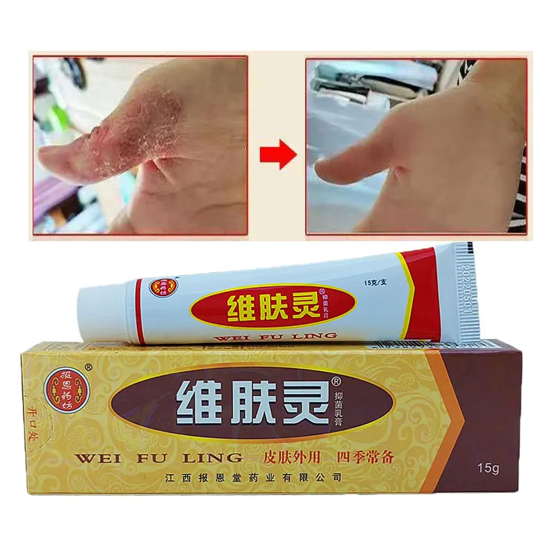 

Psoriasis Ointment Atopic DermatiTis Cream Herbal Effective Antibacterial Cream Dermatitis Eczematoid Eczema Ointment