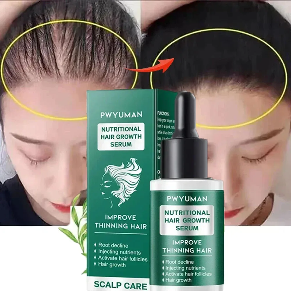 Сыворотка для роста волос против выпадения быстрый рост уход за волосами эфирное