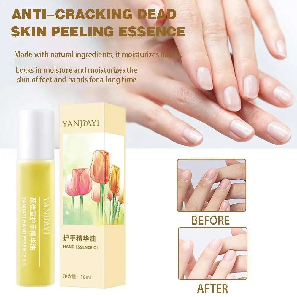 

10ml Hand Essence Roll-On Oil Anti-Cracking Dead Skin Peeling Hands Feet Skin Whitening Moisturizing Nourishing Finger Oils