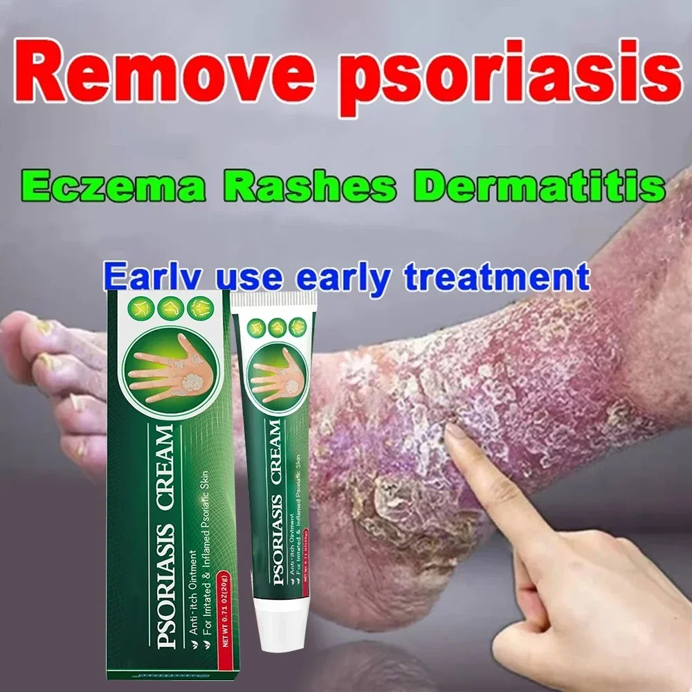 Антибактериальный крем от псориаза кожи натуральный рашпиха против зуда