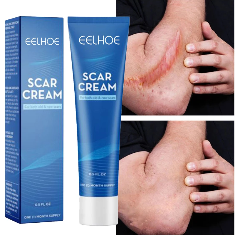 

Scar Removal Cream Repairing Pock Mark Burn Surgical Scar Cesarean Scar Stretch Mark Treatment Smooth Moisturize Skin Care 30g