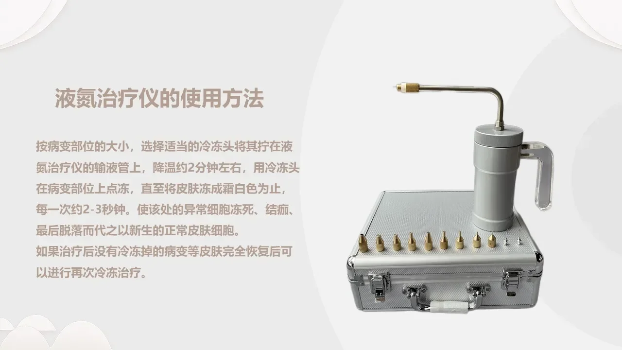 Заморозка жидкого азота для удаления бородавок веснушек морозильной камеры с