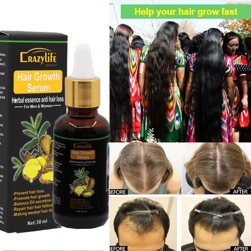 Growth Oil For Black Women