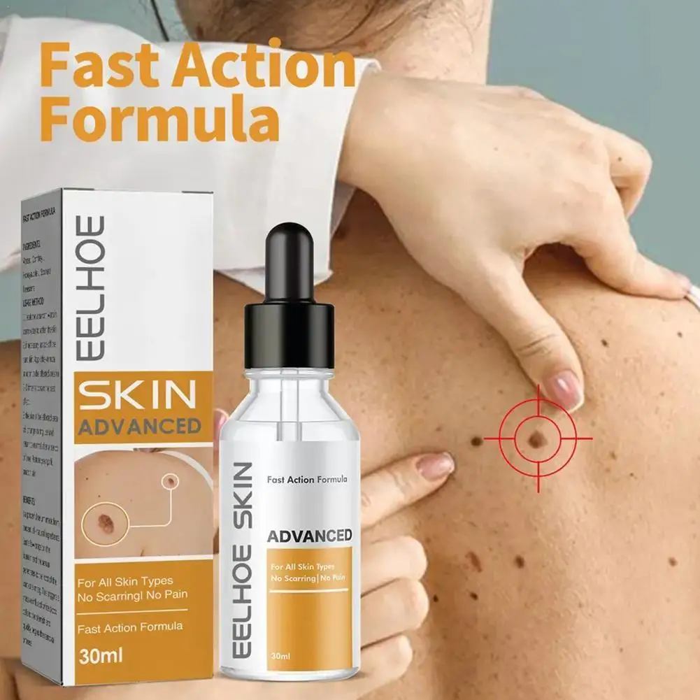 

30ml Wart Removal Essence Skin Cleansing Meat Thorns Painless Warts Corns and Hands Removal Plantar Beauty Wart Feet Flat U2U7