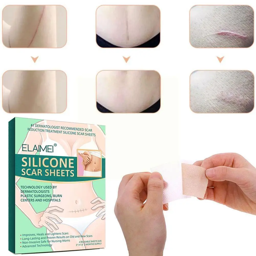 

Reusable Silicone Scar Sheets Removal Patch Acne Gel Scar Silicon Repair Remove Patch Sheet 2022 Therapy Burn Skin Trauma Q9x9