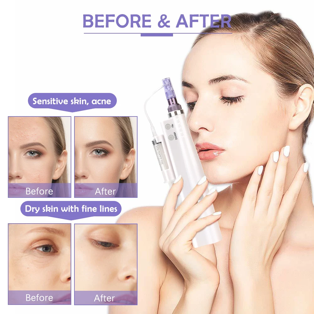 

Hydra Injector Derma Pen Mesotherapy Aqua Derma Pen With Needles and Tube 2 in 1 Portable Smart Pen Facial Injection Machine