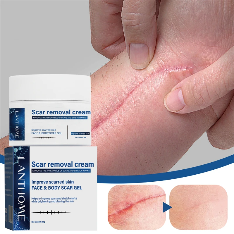 

Крем для удаления шрамов, средство для лечения растяжек, хирургический крем для удаления шрамов, отбеливающий уход за кожей