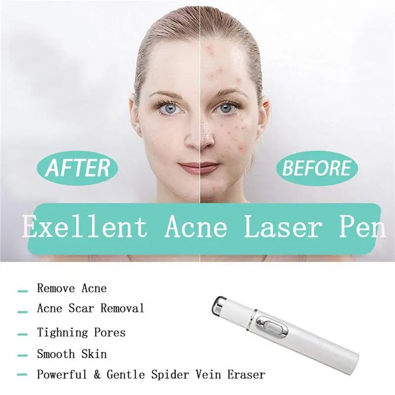 

1pcs Therapy Varicose Veins Treatment Laser Pen Soft Scar Wrinkle Removal Treatment Acne Laser Pen Massage Relax Blue Light