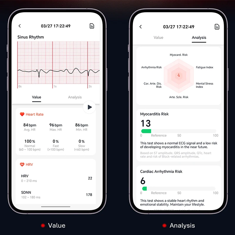 Фото Смарт-часы VALDUS VANTA ECG для мужчин и женщин с функцией SOS, оповещением о падении, фитнес-трекером, монитором сердечного ритма, давления и сна, новый браслет 2026 года №3