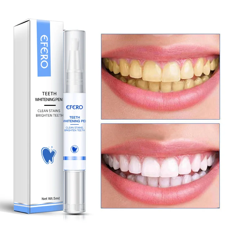 Teeth Whitening Pen Effective Remove Stains Plaque Whiten Teeth Fresh Breath Odor Removal Oral Hygiene Cleaning Beauty Health