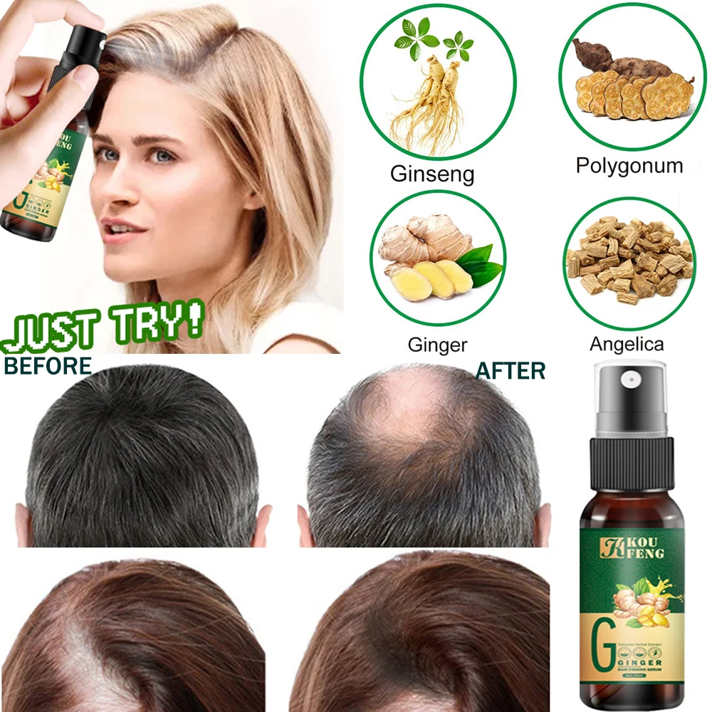 

Koufeng Ginger Hair Growth Spray Serum For Anti Hair Loss Essential Oil Fast Treatment Prevent Hair Thinning Dry Frizzy Repair