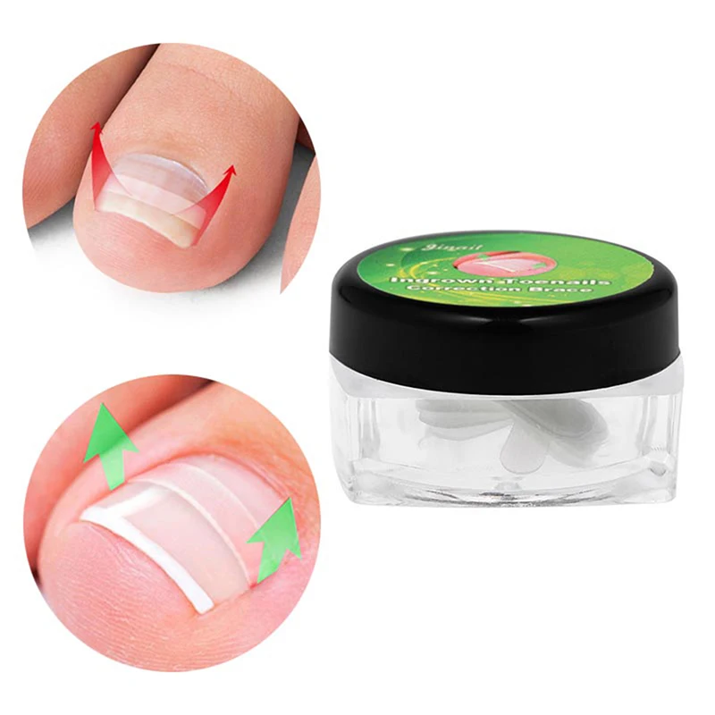 

10Pcs/Box Ingrown Toenail Correction Tool Ingrown Toe Nail Treatment Elastic Patch Sticker Straightening Clip Brace Pedicure