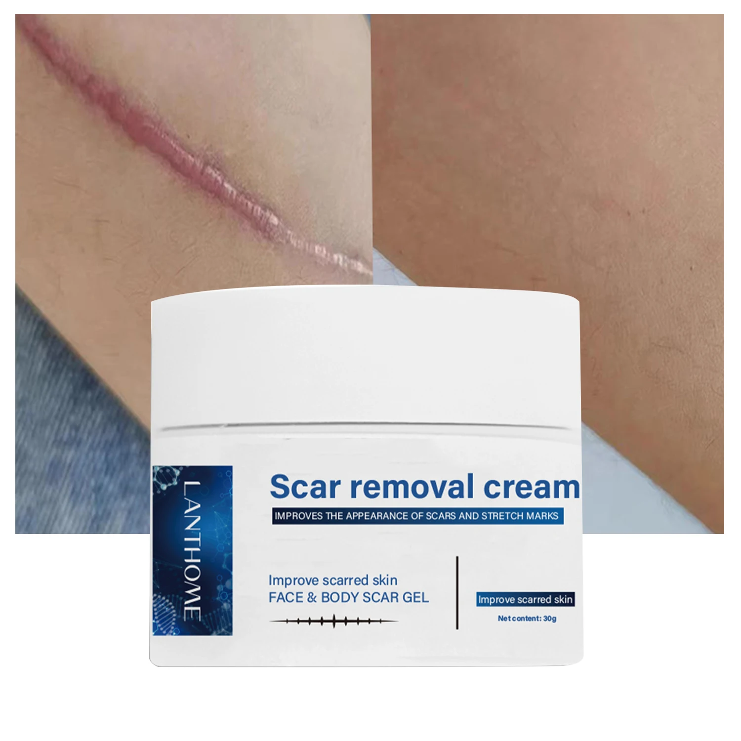 

Scar Removal Cream Repair Pock Mark Burn Surgical Scar Cesarean Stretch Herbal Treatment Gel Whitening Burn Scald Severe Scars