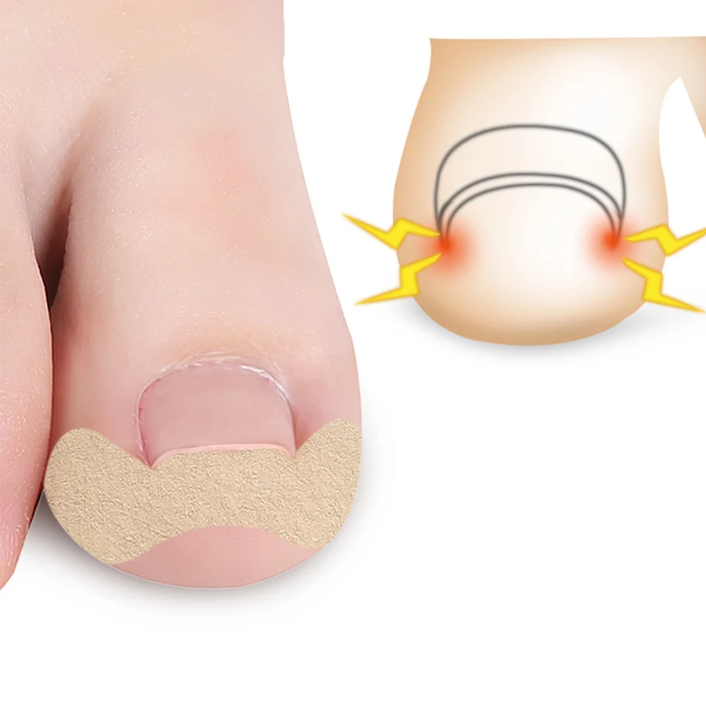 1 Sheet Professional Toenail Foot Corrector Stickers Elasticity Toe Nail Care Pedicure Tools Health Care Protects Toe Nail