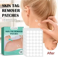 120pcs wart removal patches skin tag remover tool treatments acne foot corn kernel flat wart anti infective invisible sticker