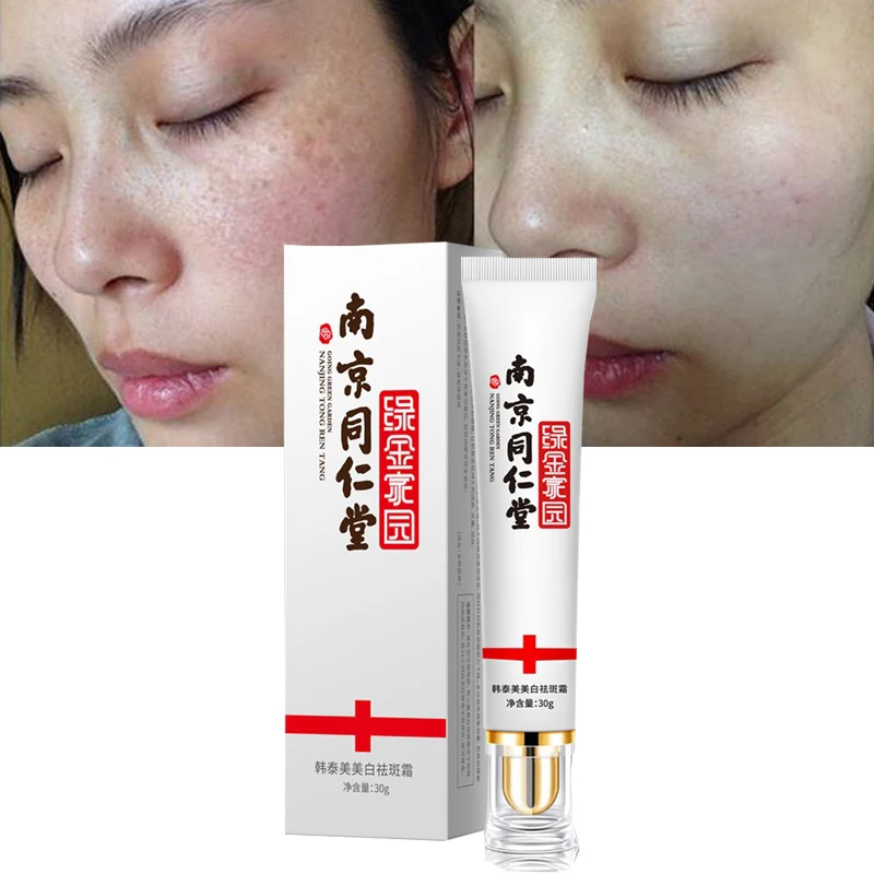 

30 г отбеливающий крем для лица ретинол удаление веснушек мелазмы пигмент меланин солнечные ожоги пятна для беременности акне темные пятна