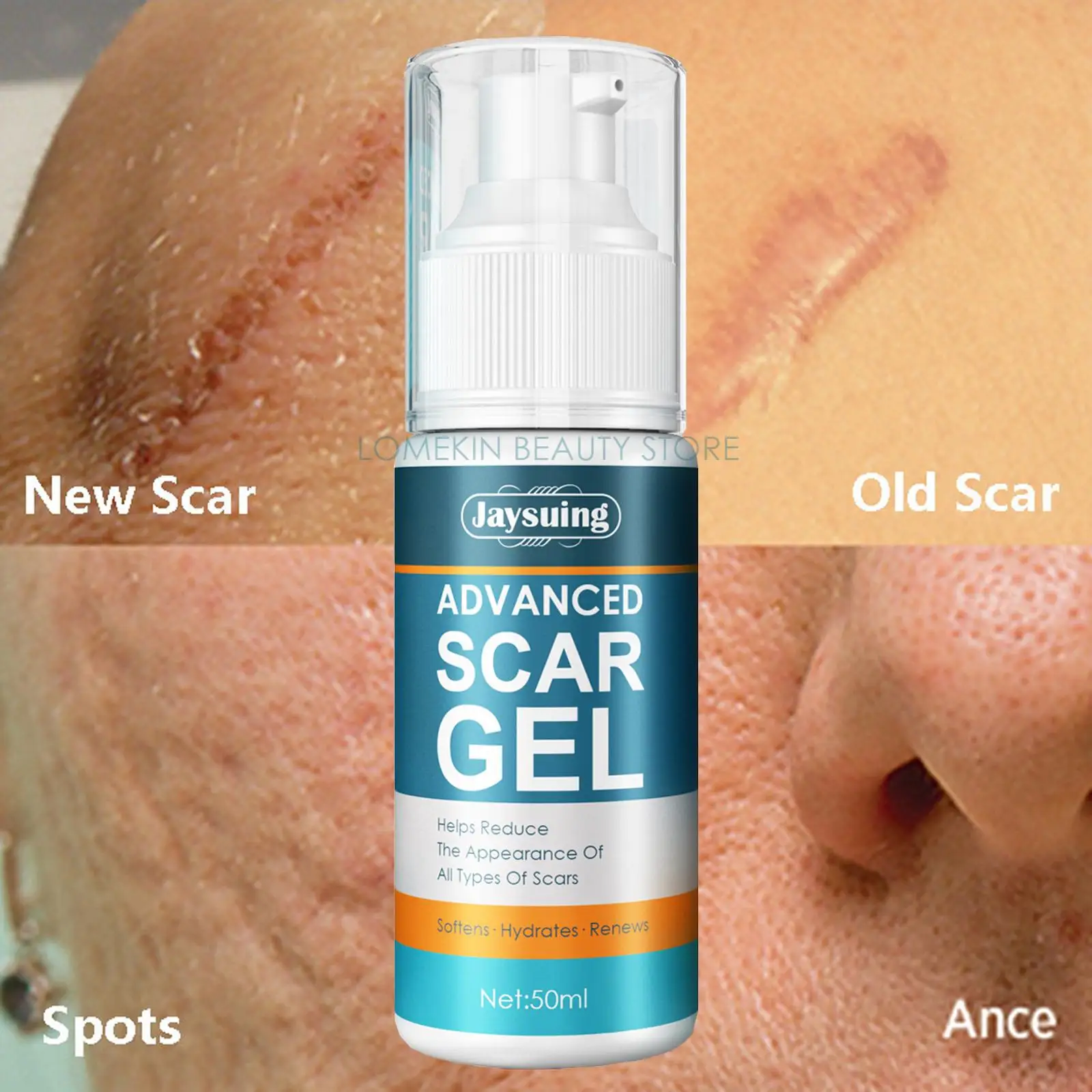 

Advanced Scar Removal Cream Remove Body Stretch Marks Smoothing Acne Pimples Repair Gel Burn Surgical Treatment Care Products