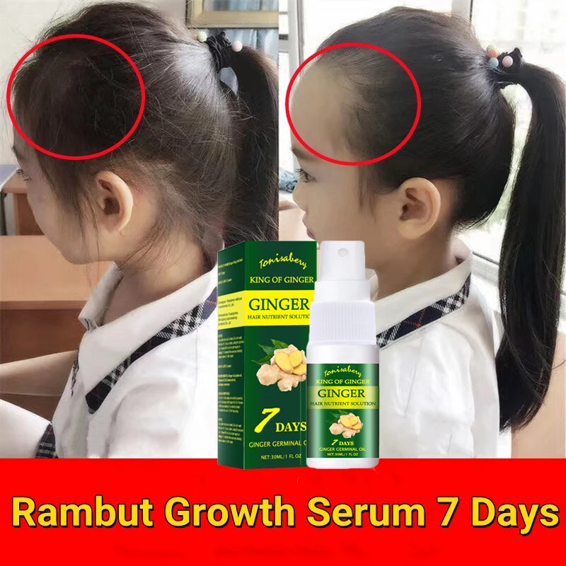 

7Days Ginger Hair Growth Spray Help Hair Grow Prevent Baldness Root Nourishing Hair Loss Treatment Solution Hair Care Unisex