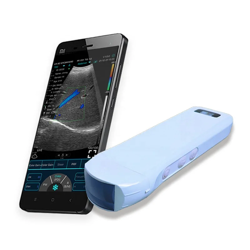 

Clinical Analysis Instruments WIFI&USB 3 IN 1 Wireless 4D Ultrasound Machine