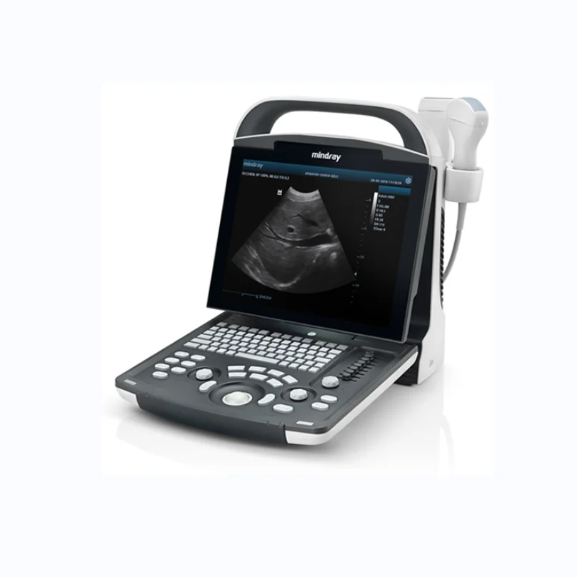 

Mindray DP-10 DP-20 Black And White Ultrasound Machine All-digital Portable Ultrasound Diagnostic System Tablet Reader
