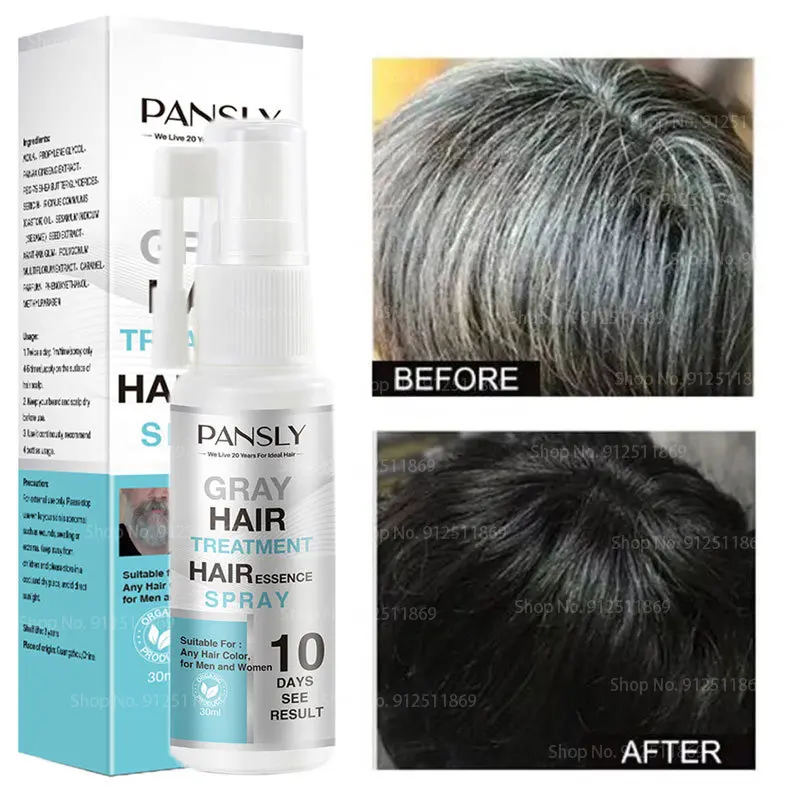 

White Hair Beard Treatment Spray Instant Herbal Restoration Black Hair Reduce White Gray Hair Scalp Nourish Repair Product 30ml