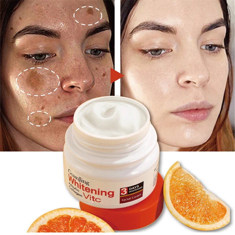 

Whitening Freckle Cream Remove Melasma Dark Spot Lightening Melanin Brightening Melasma Remover Moisturizer Anti-aging Face Care