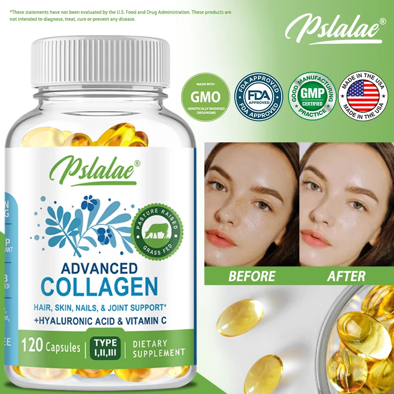 

Collagen Capsules - with Hyaluronic Acid & Vitamin C - Skincare Anti-aging, Hair, Nails & Skin Health