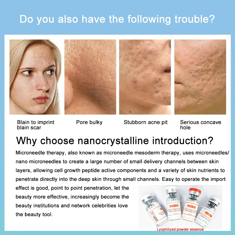 Рисунок 4 - Электрическая ручка DermaPen X3